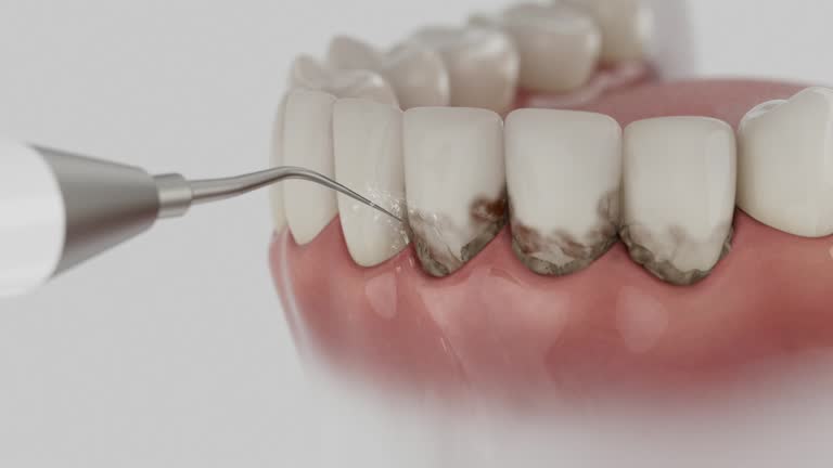 Reliable Dental contractor in Conashaugh Lakes, PA by Dentist Open Now